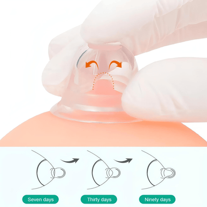 Momsolutions Nipple Corrector